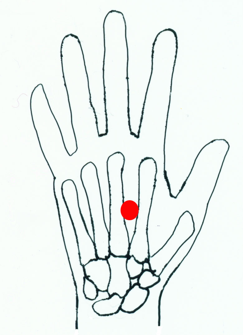 lao gong - acupuncture point picture